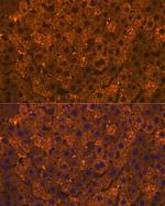 SULT2A1 Antibody in Immunohistochemistry (Paraffin) (IHC (P))