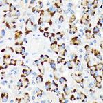 A-Raf Antibody in Immunohistochemistry (Paraffin) (IHC (P))