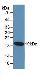 KISS1 Antibody in Western Blot (WB)