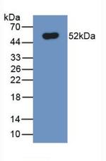 Ferroportin Antibody in Western Blot (WB)