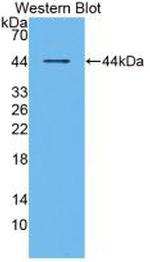 RANK (CD265) Antibody in Western Blot (WB)