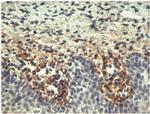 Tenascin C Antibody in Immunohistochemistry (Paraffin) (IHC (P))