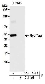 Myc Tag Antibody in Immunoprecipitation (IP)