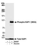 Phospho-TRIM28 (Ser824) Antibody in Western Blot (WB)