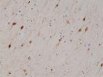 Calretinin Antibody in Immunohistochemistry (Paraffin) (IHC (P))