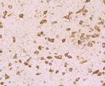 GRP94 Antibody in Immunohistochemistry (Paraffin) (IHC (P))