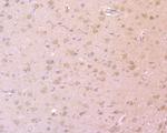 PSD-95 Antibody in Immunohistochemistry (Paraffin) (IHC (P))