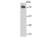 Lamin B2 Antibody in Immunocytochemistry (ICC/IF)