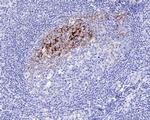 CD23 Antibody in Immunohistochemistry (Paraffin) (IHC (P))