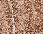 PIN4 Antibody in Immunohistochemistry (Paraffin) (IHC (P))