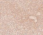 ACAT1 Antibody in Immunohistochemistry (Paraffin) (IHC (P))