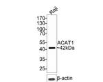 ACAT1 Antibody in Western Blot (WB)