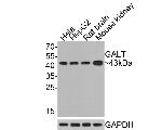 GALT Antibody in Western Blot (WB)