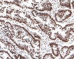 SAFB Antibody in Immunohistochemistry (Paraffin) (IHC (P))