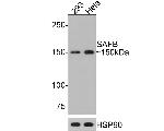 SAFB Antibody in Western Blot (WB)