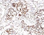 Nucleolin Antibody in Immunohistochemistry (Paraffin) (IHC (P))