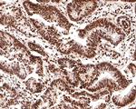 Nucleolin Antibody in Immunohistochemistry (Paraffin) (IHC (P))