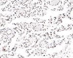 Nucleolin Antibody in Immunohistochemistry (Paraffin) (IHC (P))