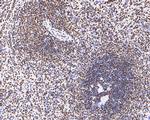 Nucleolin Antibody in Immunohistochemistry (Paraffin) (IHC (P))