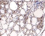 Nucleolin Antibody in Immunohistochemistry (Paraffin) (IHC (P))