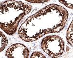 FGFR1OP Antibody in Immunohistochemistry (Paraffin) (IHC (P))