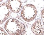 Kinesin 5B Antibody in Immunohistochemistry (Paraffin) (IHC (P))