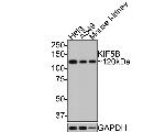 Kinesin 5B Antibody in Western Blot (WB)