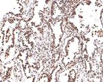 PER2 Antibody in Immunohistochemistry (Paraffin) (IHC (P))