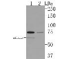 TRIP10 Antibody in Western Blot (WB)