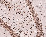 TAF15 Antibody in Immunohistochemistry (Paraffin) (IHC (P))