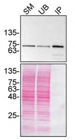 TAF15 Antibody in Immunoprecipitation (IP)