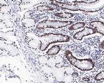 SR Antibody in Immunohistochemistry (Paraffin) (IHC (P))