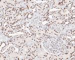 CPSF3 Antibody in Immunohistochemistry (Paraffin) (IHC (P))