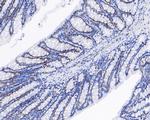 CPSF3 Antibody in Immunohistochemistry (Paraffin) (IHC (P))