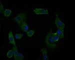 UBE4A Antibody in Immunocytochemistry (ICC/IF)