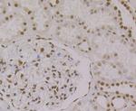 PTBP1 Antibody in Immunohistochemistry (Paraffin) (IHC (P))