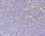 PTBP1 Antibody in Immunohistochemistry (Paraffin) (IHC (P))