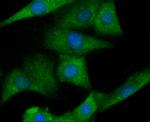 IL-6 Antibody in Immunocytochemistry (ICC/IF)