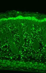 HSPB8 Antibody in Immunohistochemistry (Paraffin) (IHC (P))