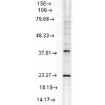 HSPB8 Antibody in Western Blot (WB)