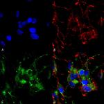 HCN2 Antibody in Immunocytochemistry (ICC/IF)