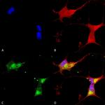 Kir2.1 (KCNJ2) Antibody in Immunocytochemistry (ICC/IF)