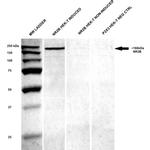 NMDAR2B Antibody in Western Blot (WB)