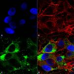 SCN10A Antibody in Immunocytochemistry (ICC/IF)