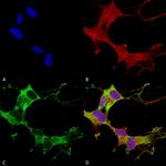 GABRA1 Antibody in Immunocytochemistry (ICC/IF)