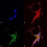 VGLUT3 Antibody in Immunocytochemistry (ICC/IF)