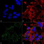 VGLUT3 Antibody in Immunocytochemistry (ICC/IF)