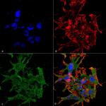 GABBR1 Antibody in Immunocytochemistry (ICC/IF)