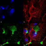 LRP4 Antibody in Immunocytochemistry (ICC/IF)