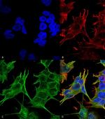 NMDAR2A Antibody in Immunocytochemistry (ICC/IF)